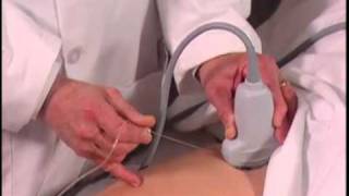 Ultrasound Guided Hip Injection SonoSite [upl. by Yasu432]