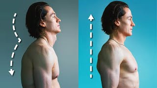 How I Fixed My Terrible Posture  5 Habits [upl. by Yentruok]