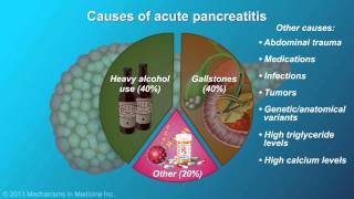 Acute Pancreatitis [upl. by Foulk]