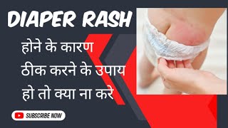 Diaper Rashes Home Remedies Reasons Remedies and What cant do momscando diaperrash [upl. by Vilma]