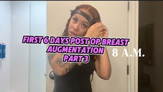 First 6 days post op breast augmentation  Part 3 [upl. by Ries545]