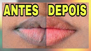 Como clarear os labios escuros causados do fumo [upl. by Judus547]