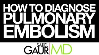 How to Read a CT Pulmonary Angiogram Part II How to Diagnose a Pulmonary Embolism [upl. by Asilec]