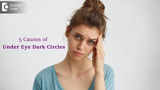 5 Top Causes of Dark Circles  Know what Causes Dark Circles  Dr Renuka Shetty  Doctors Circle [upl. by Ravel]