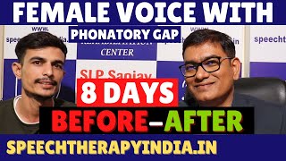 Transforming Female Voice With Phonatory Gap in Just 8 Days  AIIMS Delhi Alumnus slpsanjaykumar [upl. by Wight]