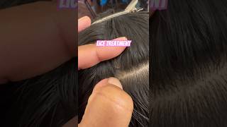 Head lice treatment on a client l head lice removal service [upl. by Lirrehs]