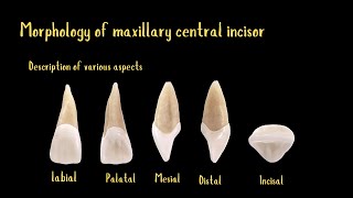 Morphology of maxillary central incisor [upl. by Nylcoj]