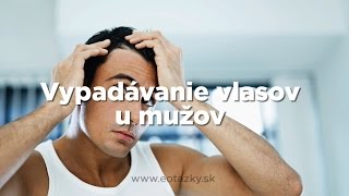 Vypadávanie vlasov u mužov [upl. by Bauske533]