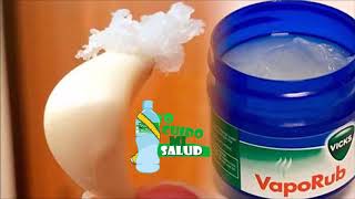 ASMA y Vick Vaporub [upl. by Arimas]