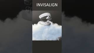 Invisalign Underbite  Time Lapse  London UK [upl. by Orvil]