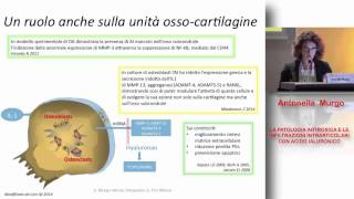 Artrosi e infiltrazioni intraarticolari con acido ialuronico [upl. by Sisi]