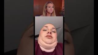 Try Not To Laugh Challenge 485 🤣 funny shorts viral [upl. by Nunes969]