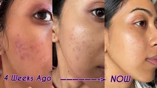 Holy Grail Skincare that Helped my Skin to Fade Dark Spots and Pigmentation  Results Shown [upl. by Arihaz]