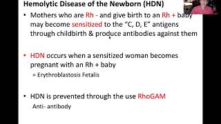 Hemolytic Disease of the Newborn HDN [upl. by Laehcym]