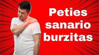 Peties sanario burzitas Kas tai kaip gydyti Kineziterapijos pratimai [upl. by Longmire]