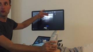 Demo echografie laterale heup  gluteii en tractus  lengte [upl. by Sisely]