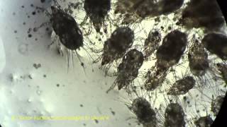 Under Microscope Flour Mites Acarus siro Acarina Acaridae Kiev Ukraine [upl. by Leda28]