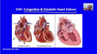 Congestive v Diastolic Heart Failure CHF by NIK NIKAM MD [upl. by Cilegna378]