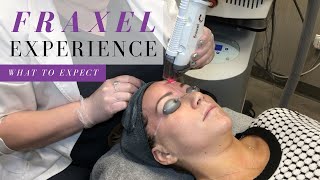 Whats It Like to Get Fraxel Laser Skin Resurfacing Experience [upl. by Daney]