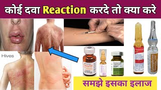 दवा Reaction होने पर क्या करे   Medicine Reaction Treatment  Drugs Reaction का इलाज [upl. by Steffen995]