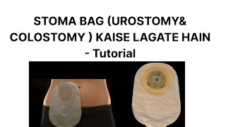 UROSTOMYCOLOSTOMY BAG KAISE LAGATE HAI  TUTORIAL patientcare [upl. by Lidstone]