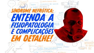 Síndrome Nefrótica Entenda a Fisiopatologia e Complicações em Detalhe [upl. by Borgeson790]