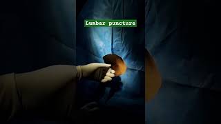 Lumbar puncture lumbarpuncture lumbarpunctureprocedure TechhealthOT [upl. by Bern784]