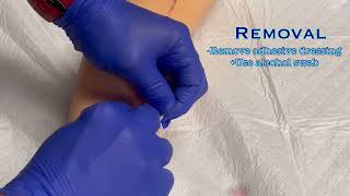 Peripheral IVs Removing the IV [upl. by Nate]