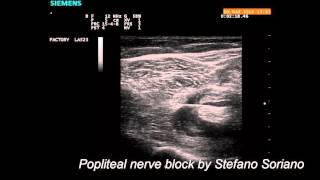 Ultrasound guided popliteal nerve block [upl. by Nosral553]