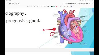 valvular heart disease [upl. by Hike942]