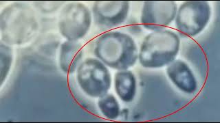 من إبداعات الخلق عز وجل فى خلقه quotتكاثر الخميرة بالتبرعمquot ؟Yeast cell budding [upl. by Einnoc]