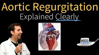 Aortic Regurgitation Insufficiency Explained Clearly [upl. by Bright]