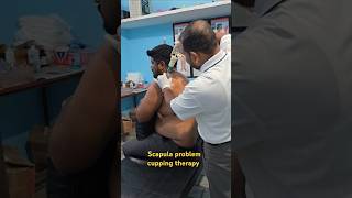 Scapula problem cupping therapy treatment [upl. by Ynavoj]