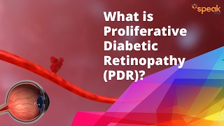 What is Proliferative Diabetic Retinopathy PDR [upl. by Latsyc]