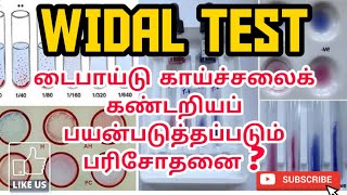 WIDAL TEST  USES  METHOD  PROCEDURE  PHARMA TAMIL  AKI  51 [upl. by Chaing]