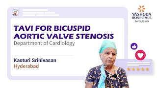 TAVI for Bicuspid Aortic Valve Stenosis  Yashoda Hospitals Hyderabad [upl. by Aryan]