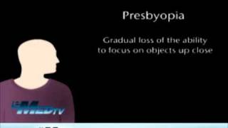 Presbyopia  Gradual Loss of Sight [upl. by Eleanor]