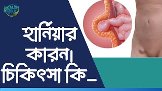 হার্নিয়ার কারন এবং চিকিৎসা কি  What is the cause and treatment of hernia [upl. by Inihor537]