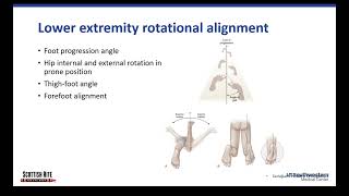 Lower Extremity Alignment [upl. by Chemush]