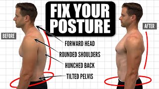 How To FIX Your Posture  10Minute Daily Routine [upl. by Llenehc346]