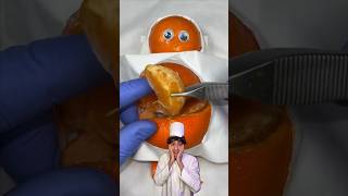 fruit surgeries 😱 viral [upl. by Snider]