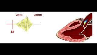 Soplo estenosis aortica [upl. by Adlih]