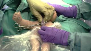 Delayed Cord Clamping [upl. by Kcirdef]