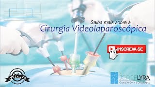 Cirurgia Videolaparoscópica [upl. by Alrahs]