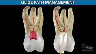 ProTaper GOLD  Shaping the Future of Endodontics Advanced Endodontics [upl. by Tremann]