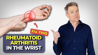 Rheumatoid Arthritis In The Wrist  How To Fix It [upl. by Horowitz46]