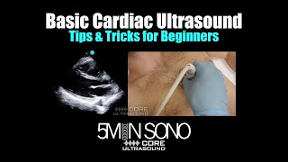 Basic Cardiac Ultrasound Tips and Tricks for Beginners [upl. by Airrej]