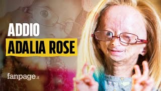 Morta Adalia Rose la youtuber 15enne che raccontava la sua vita con la progeria [upl. by Laval]