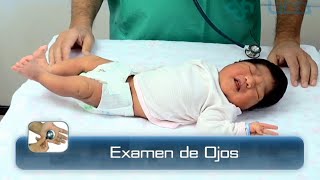 🌟EXAMEN DE OJOS DEL RECIÉN NACIDO🌟 [upl. by Odicalp]