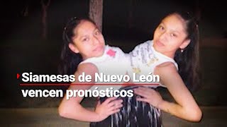 SIAMESAS QUINCEAÑERAS  Lupita y Elsa vencen los pronósticos médicos [upl. by Nedda]